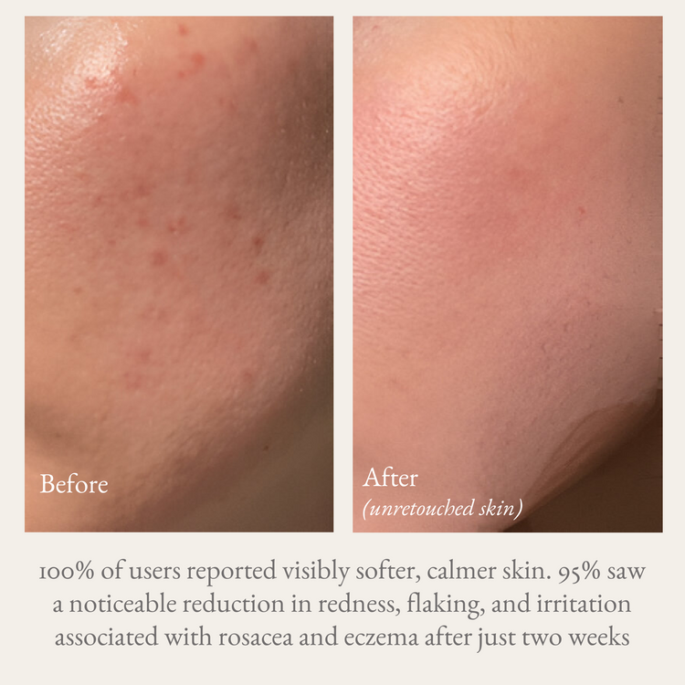 Blue Spruce | Goat Milk Hand & Body Lotion